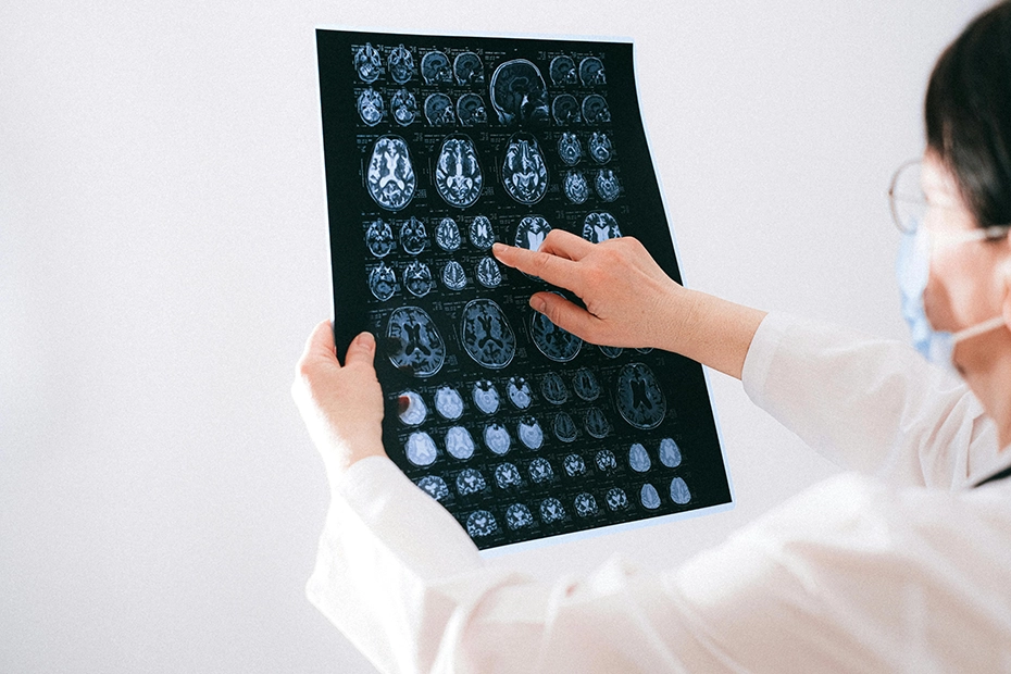 S preventivnimi strategijami lahko zelo učinkovito zmanjšamo tveganje za razvoj demence